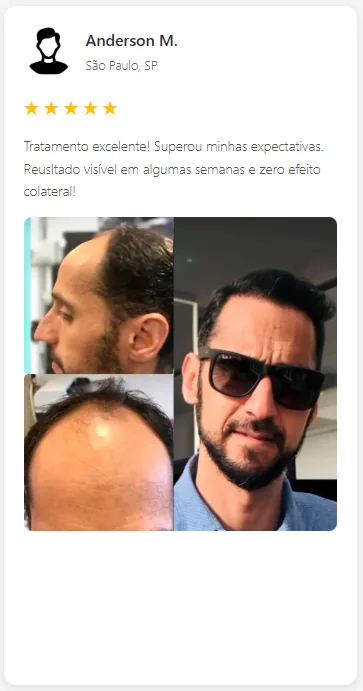 Antes e depois com relato de resultado visível em algumas semanas e boa experiência com o tratamento