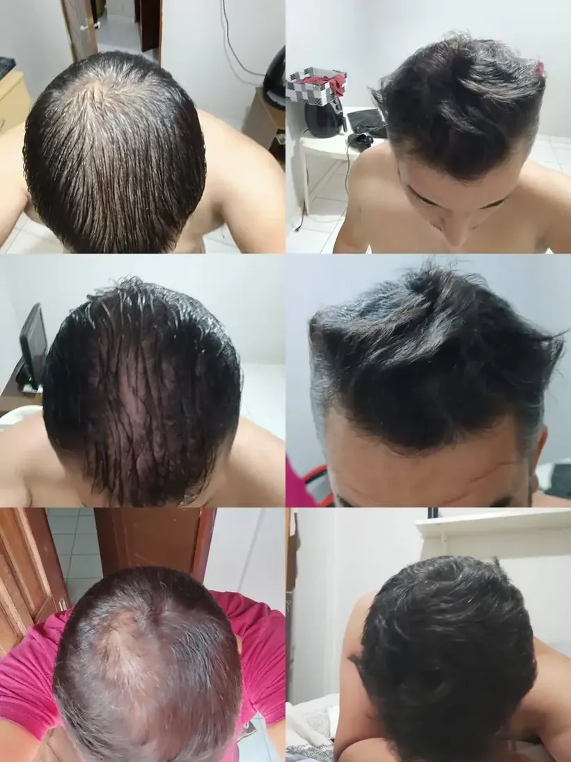 Resultado Ricardo