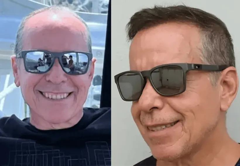 Antes e Depois de Antônio Silva