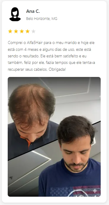 Antes e depois compartilhado por cliente que acompanhou o uso por cerca de quatro meses